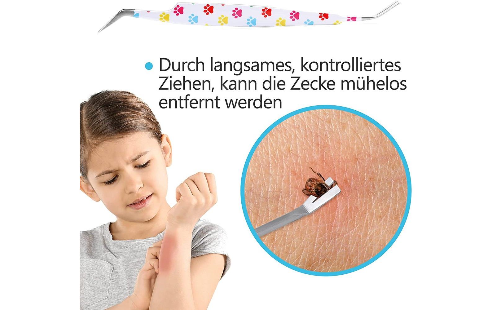 Helperfect Zeckenzange – für Erwachsene, weiss