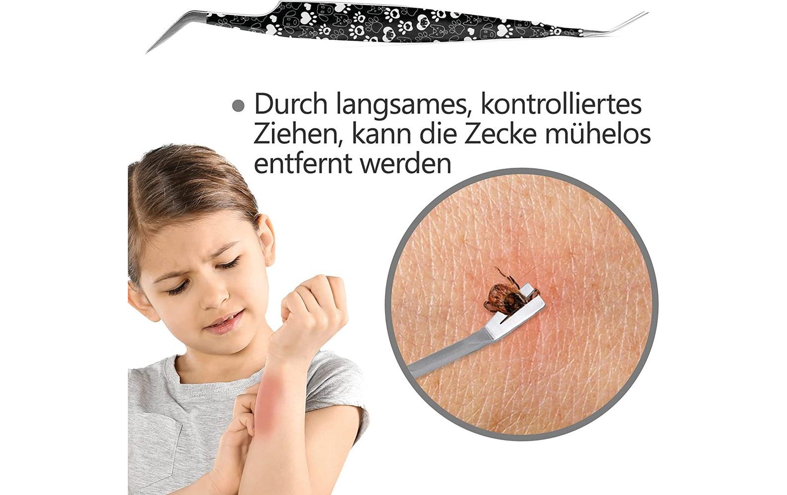 Helperfect Zeckenzange – schwarz, 1 Stück