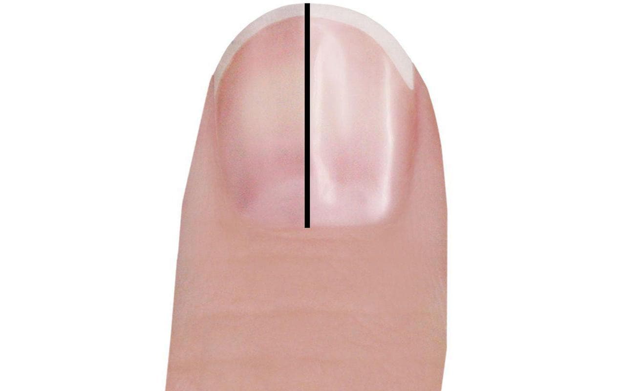 Trisa Ersatzrollen – für Trisa Perfect Nails – 3 Stk – braun, grau, weiss