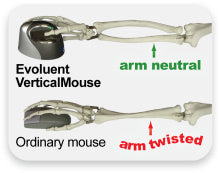Evoluent Vertical Mouse4 Small Ergonomische Maus – kabelgebunden, für Rechtshänder, vertikal