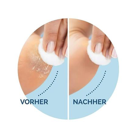 Scholl Ersatz-Rollenköpfe – für Scholl ExpressPedi Velvet – Diamantpartikel, sehr grobe Körnung – 2 Stk – schwarz