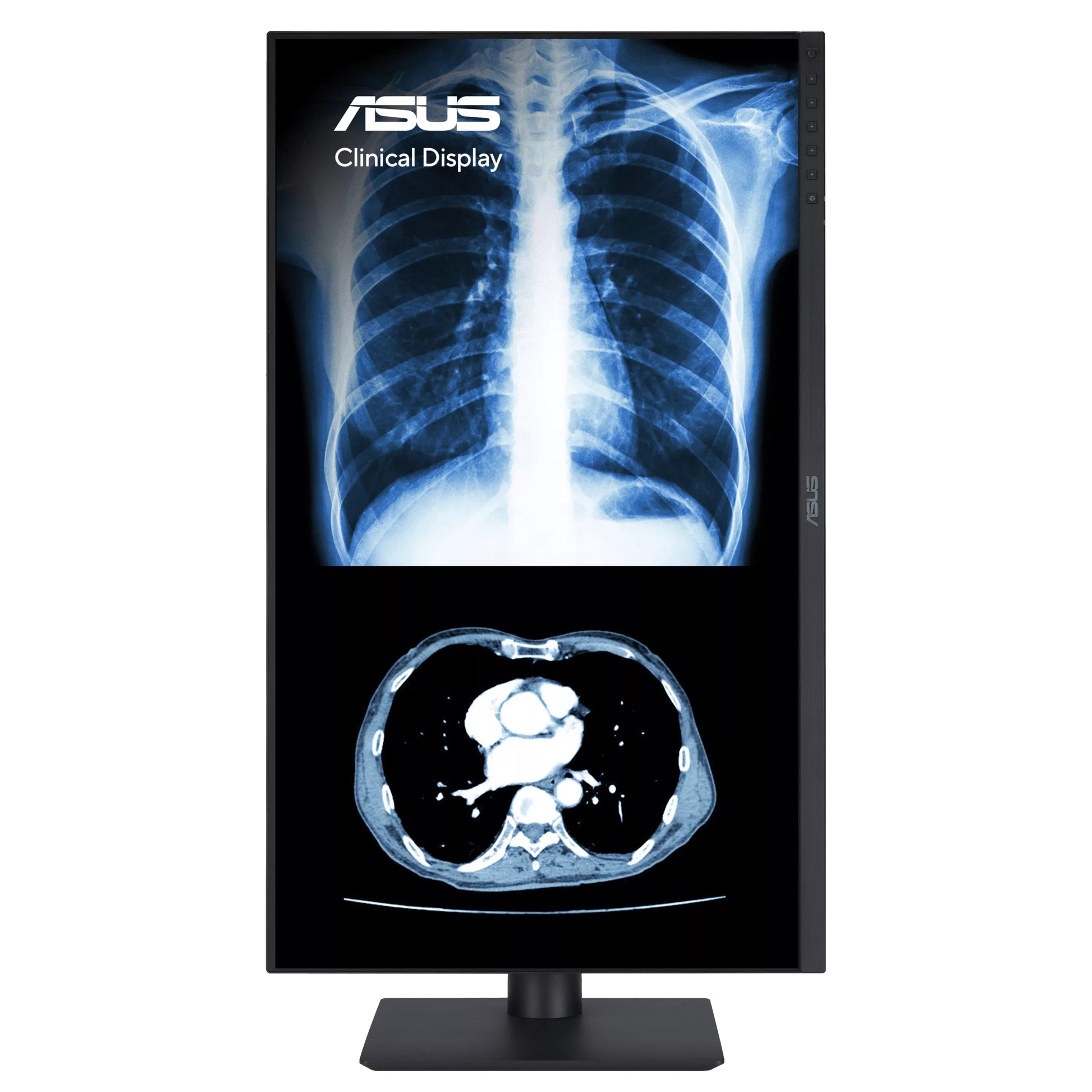 ASUS MH2441A – 23,8", 2560 × 1440 (WQHD), IPS, USB-C 15 W